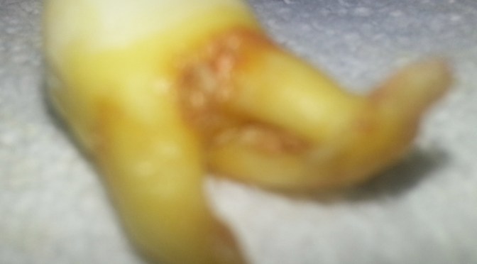 Losing a friend, losing the pain